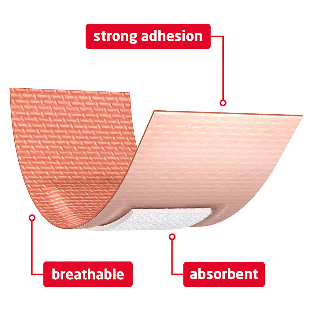 Fabric Dressings Assorted (20) 10202027